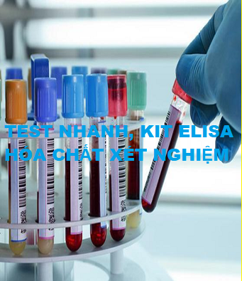 TEST NHANH, KIT ELISA, HÓA CHẤT XÉT NGHIỆM